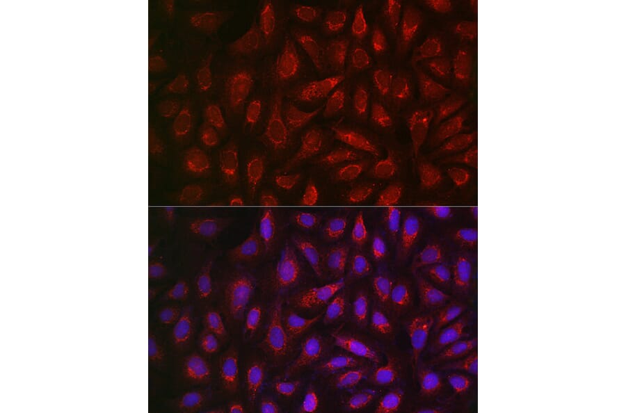 Immunofluorescence - Anti-ALDH2 Antibody (A13393) - Antibodies.com