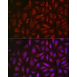 Immunofluorescence - Anti-ALDH2 Antibody (A13393) - Antibodies.com