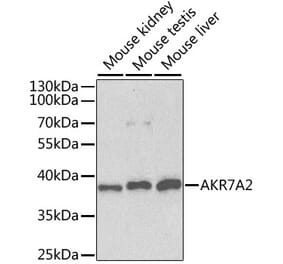 Western Blot - Anti-AKR7A2 Antibody (A1227) - Antibodies.com