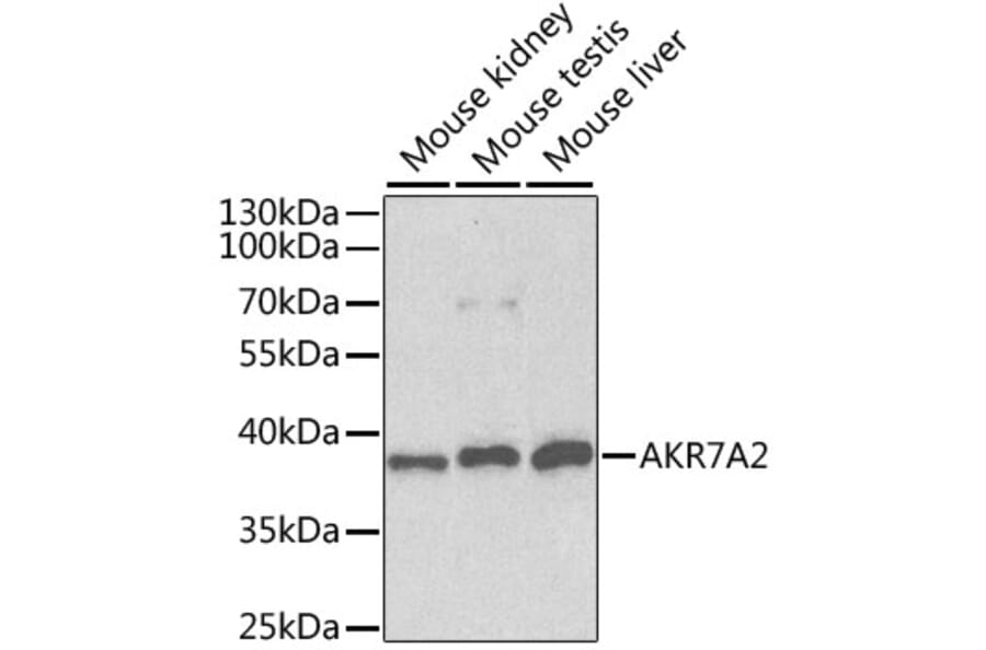 Western Blot - Anti-AKR7A2 Antibody (A1227) - Antibodies.com