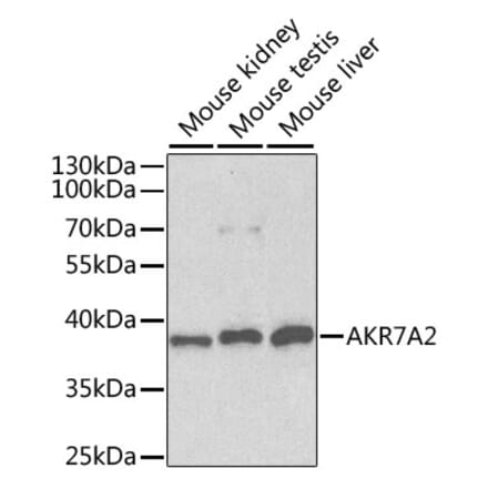 Western Blot - Anti-AKR7A2 Antibody (A1227) - Antibodies.com