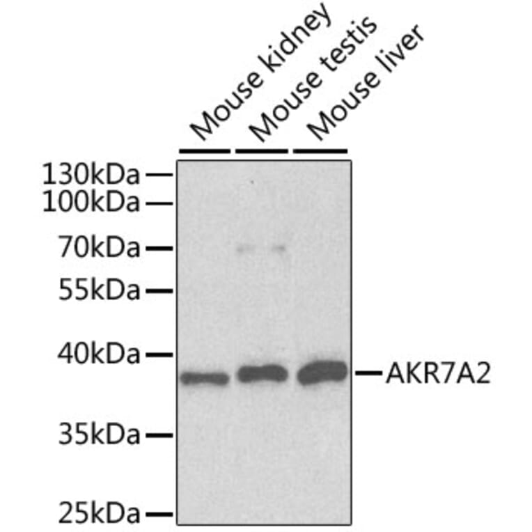 Western Blot - Anti-AKR7A2 Antibody (A1227) - Antibodies.com