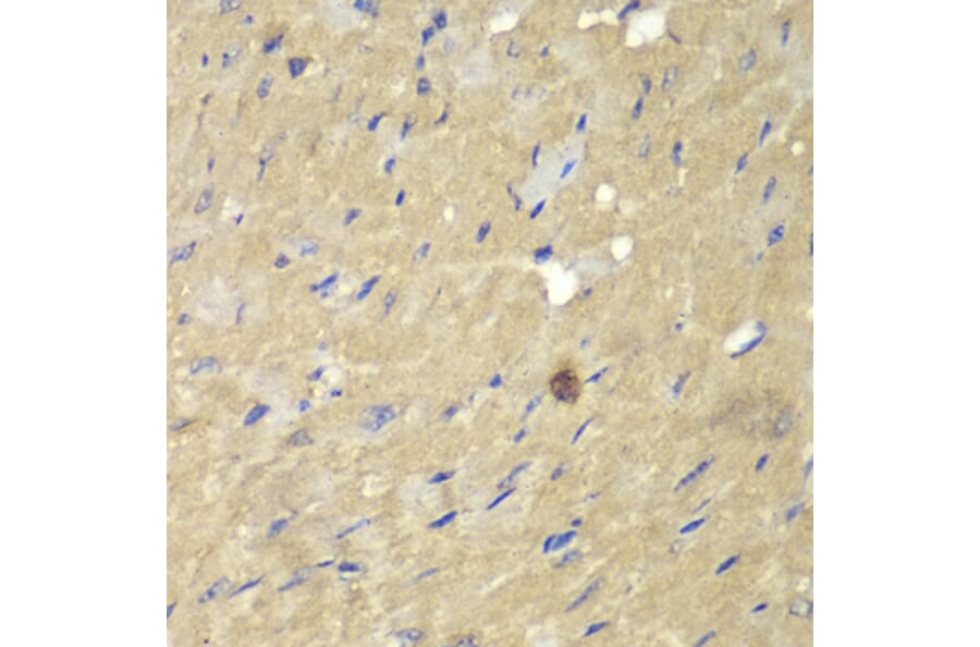 Immunohistochemistry - Anti-AKR7A2 Antibody (A1227) - Antibodies.com