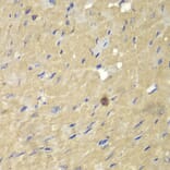 Immunohistochemistry - Anti-AKR7A2 Antibody (A1227) - Antibodies.com