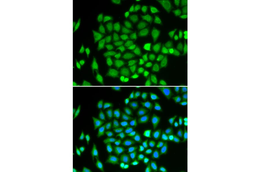 Immunofluorescence - Anti-AKR7A2 Antibody (A1227) - Antibodies.com