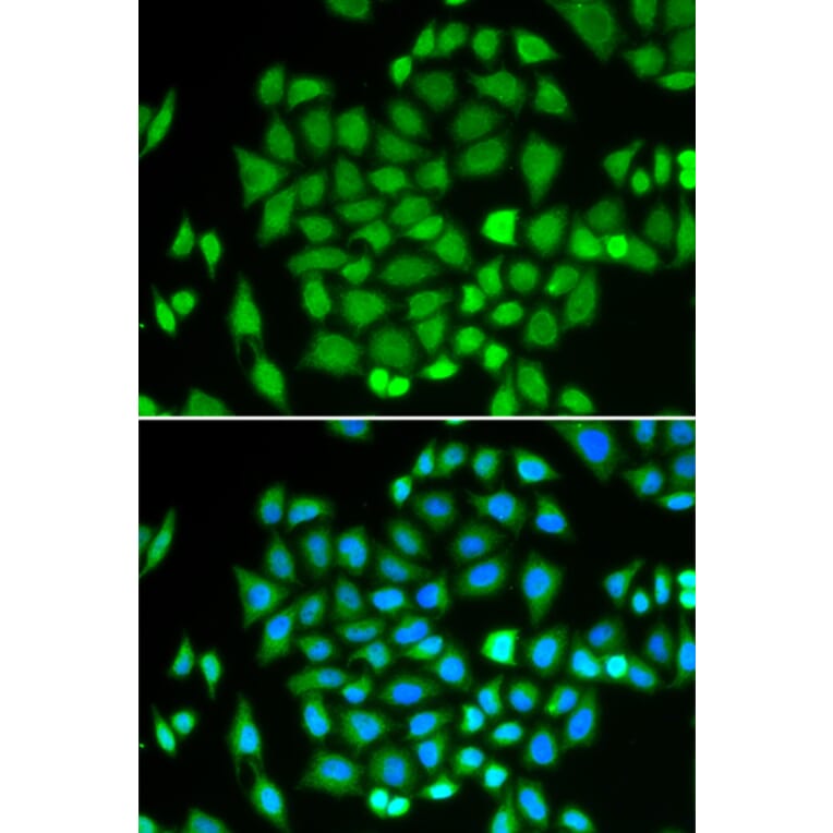 Immunofluorescence - Anti-AKR7A2 Antibody (A1227) - Antibodies.com