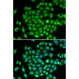 Immunofluorescence - Anti-AKR7A2 Antibody (A1227) - Antibodies.com