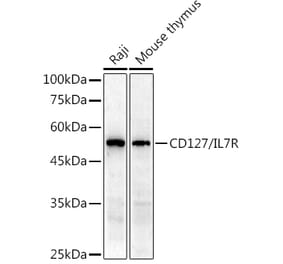 Western Blot - Anti-CD127 Antibody (A13396) - Antibodies.com