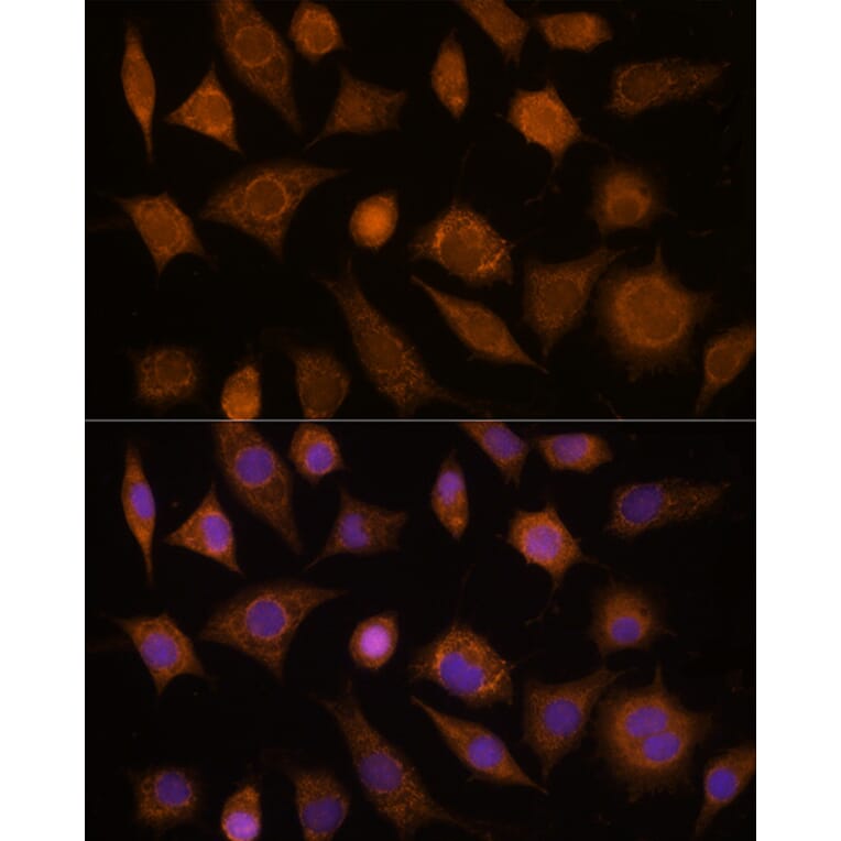 Immunofluorescence - Anti-Cdc20 Antibody (A13397) - Antibodies.com