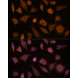 Immunofluorescence - Anti-Cdc20 Antibody (A13397) - Antibodies.com