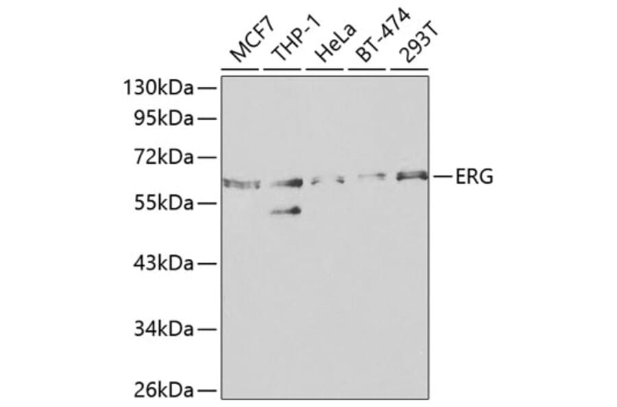Western Blot - Anti-ERG Antibody (A13399) - Antibodies.com