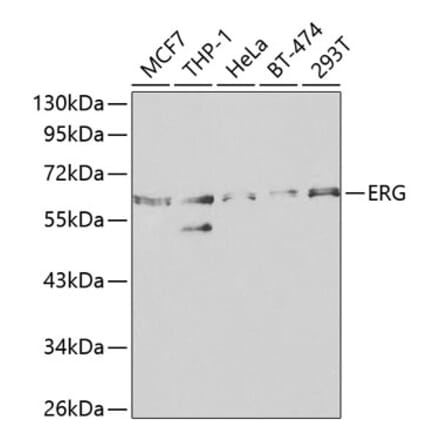 Western Blot - Anti-ERG Antibody (A13399) - Antibodies.com