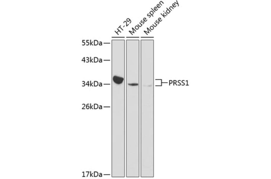 Western Blot - Anti-Trypsin Antibody (A13400) - Antibodies.com
