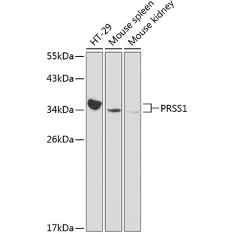 Western Blot - Anti-Trypsin Antibody (A13400) - Antibodies.com