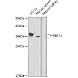 Western Blot - Anti-Trypsin Antibody (A13400) - Antibodies.com