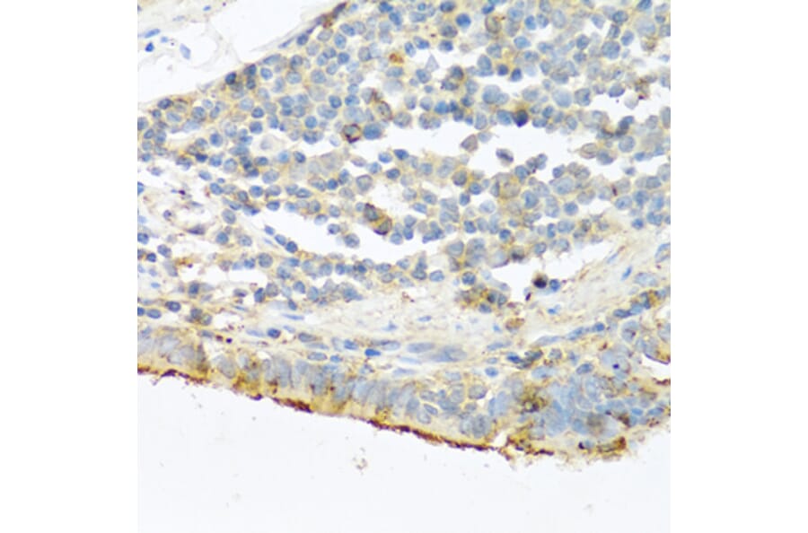 Immunohistochemistry - Anti-Trypsin Antibody (A13400) - Antibodies.com