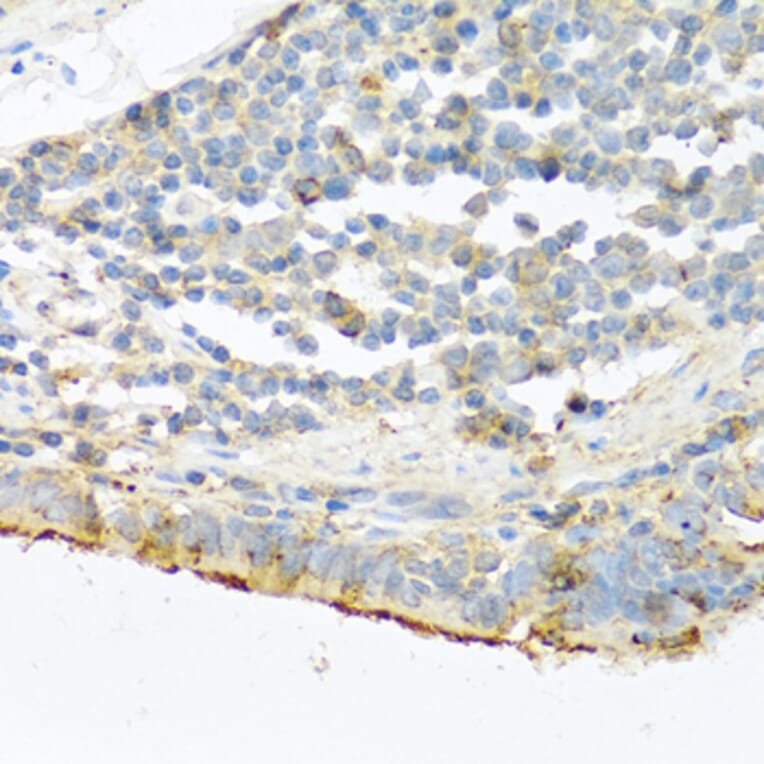 Immunohistochemistry - Anti-Trypsin Antibody (A13400) - Antibodies.com