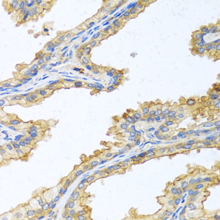 Immunohistochemistry - Anti-Trypsin Antibody (A13400) - Antibodies.com