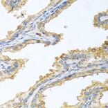 Immunohistochemistry - Anti-Trypsin Antibody (A13400) - Antibodies.com