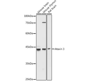 Western Blot - Anti-Ataxin 3 Antibody (A13401) - Antibodies.com