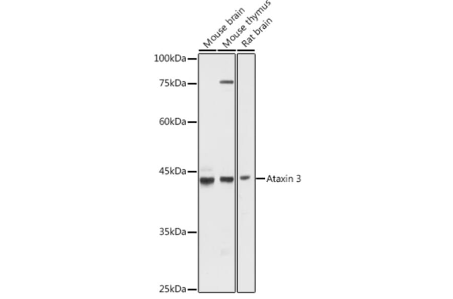 Western Blot - Anti-Ataxin 3 Antibody (A13401) - Antibodies.com