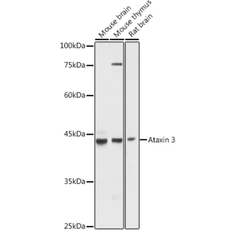 Western Blot - Anti-Ataxin 3 Antibody (A13401) - Antibodies.com