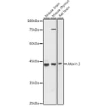 Western Blot - Anti-Ataxin 3 Antibody (A13401) - Antibodies.com