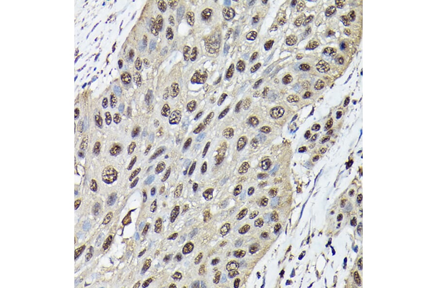 Immunohistochemistry - Anti-Ataxin 3 Antibody (A13401) - Antibodies.com