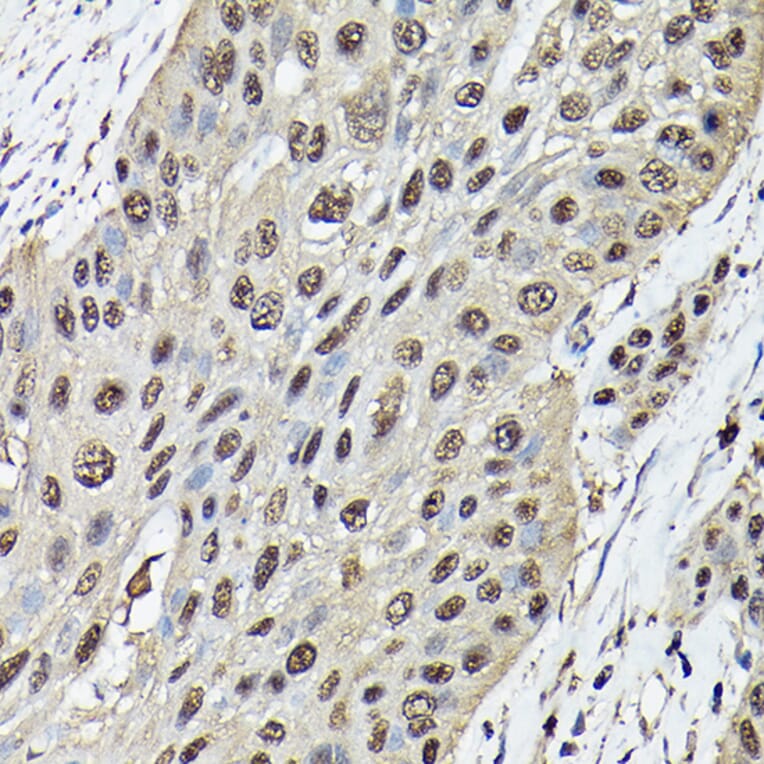 Immunohistochemistry - Anti-Ataxin 3 Antibody (A13401) - Antibodies.com