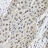 Immunohistochemistry - Anti-Ataxin 3 Antibody (A13401) - Antibodies.com