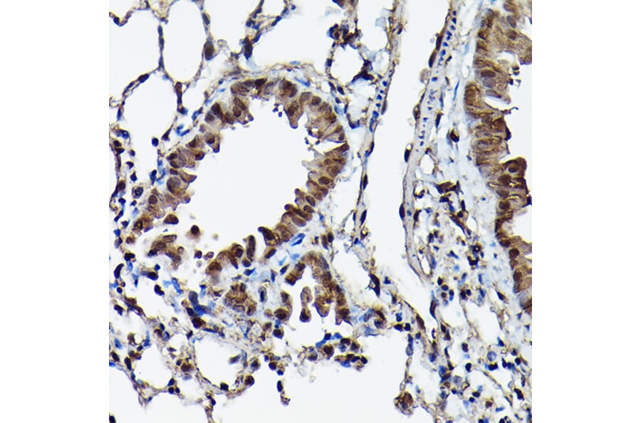 Immunohistochemistry - Anti-Ataxin 3 Antibody (A13401) - Antibodies.com