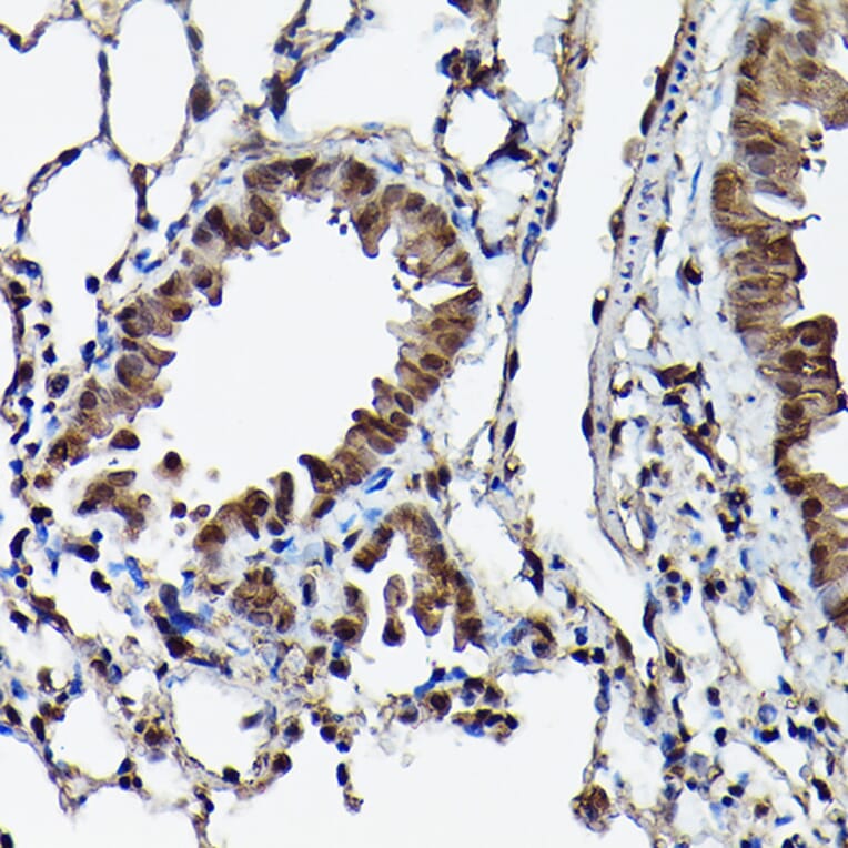 Immunohistochemistry - Anti-Ataxin 3 Antibody (A13401) - Antibodies.com