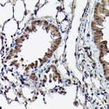 Immunohistochemistry - Anti-Ataxin 3 Antibody (A13401) - Antibodies.com