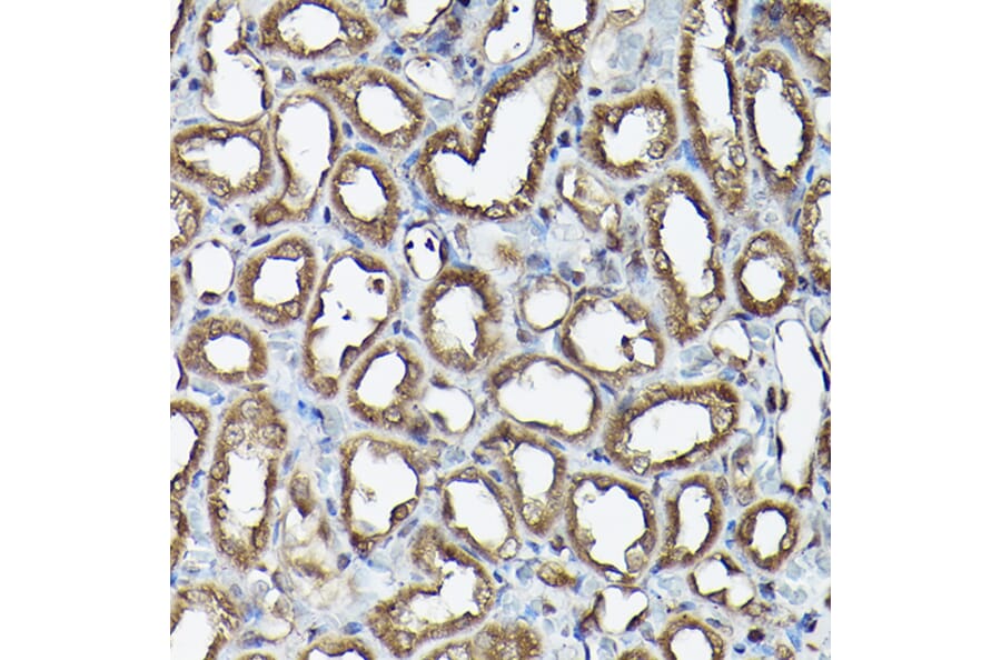 Immunohistochemistry - Anti-Ataxin 3 Antibody (A13401) - Antibodies.com