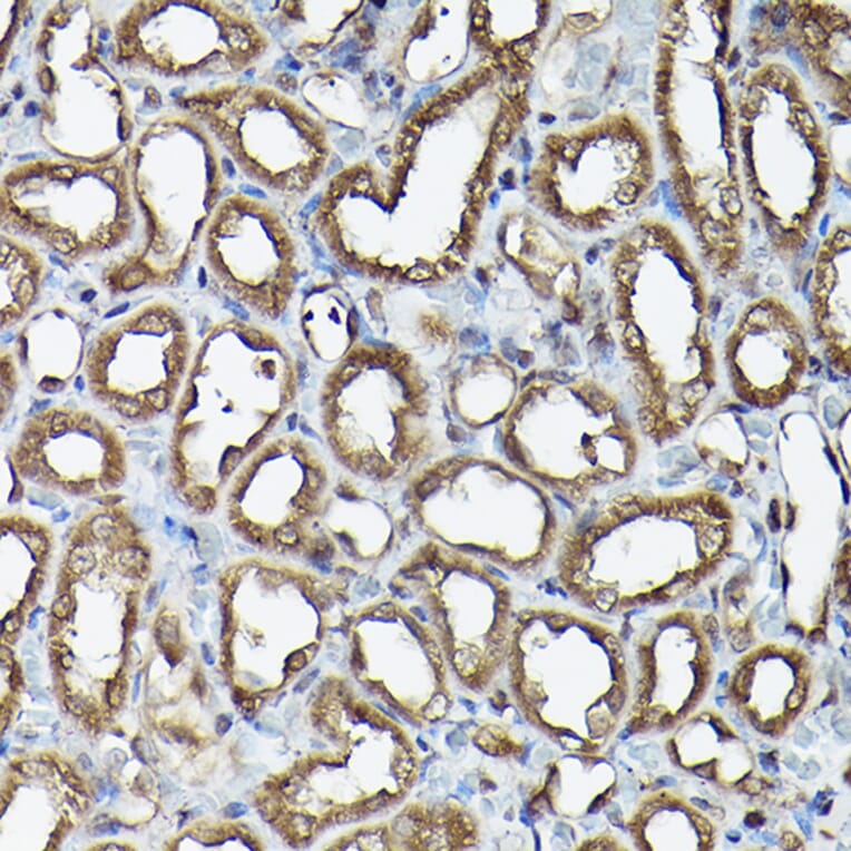 Immunohistochemistry - Anti-Ataxin 3 Antibody (A13401) - Antibodies.com