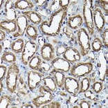 Immunohistochemistry - Anti-Ataxin 3 Antibody (A13401) - Antibodies.com