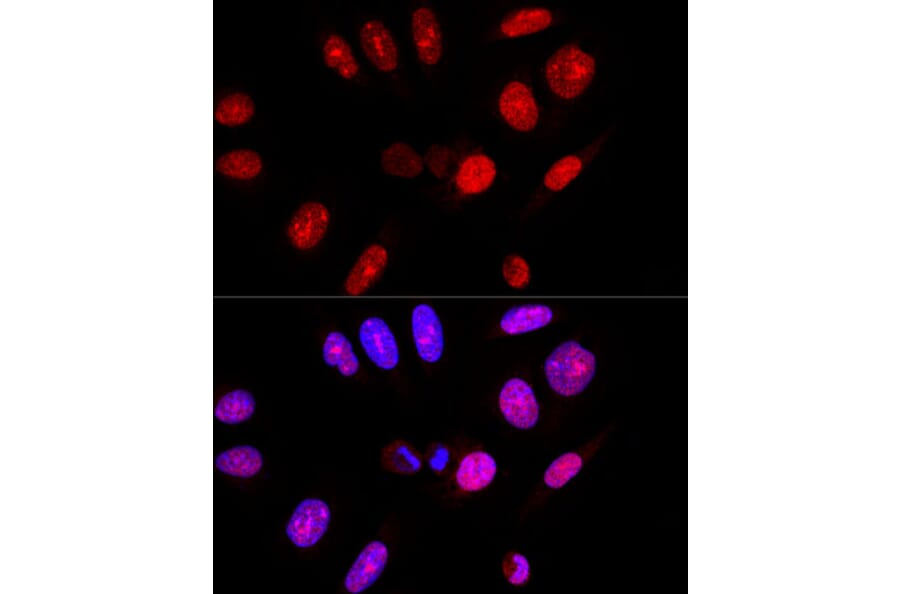 Immunofluorescence - Anti-Ataxin 3 Antibody (A13401) - Antibodies.com