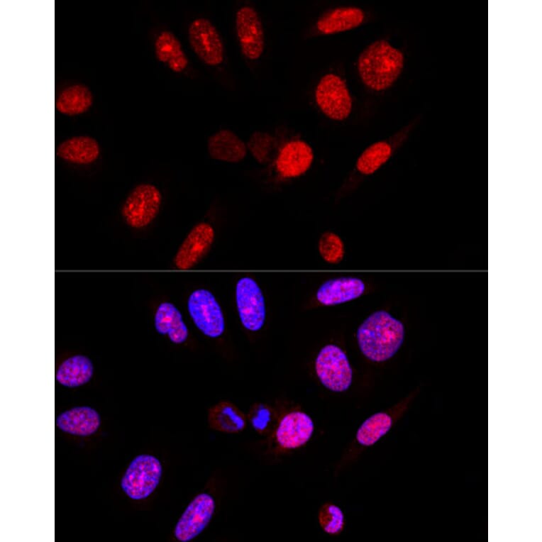 Immunofluorescence - Anti-Ataxin 3 Antibody (A13401) - Antibodies.com