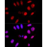 Immunofluorescence - Anti-Ataxin 3 Antibody (A13401) - Antibodies.com