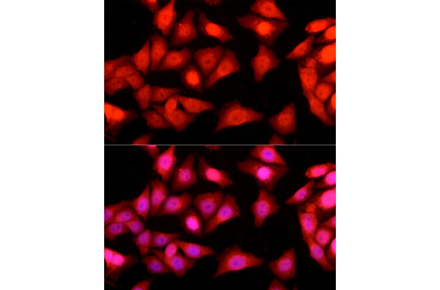 Immunofluorescence - Anti-Ataxin 3 Antibody (A13401) - Antibodies.com