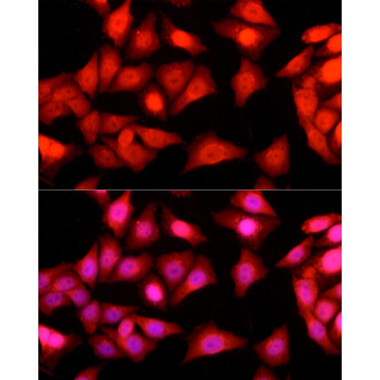 Immunofluorescence - Anti-Ataxin 3 Antibody (A13401) - Antibodies.com