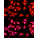 Immunofluorescence - Anti-Ataxin 3 Antibody (A13401) - Antibodies.com