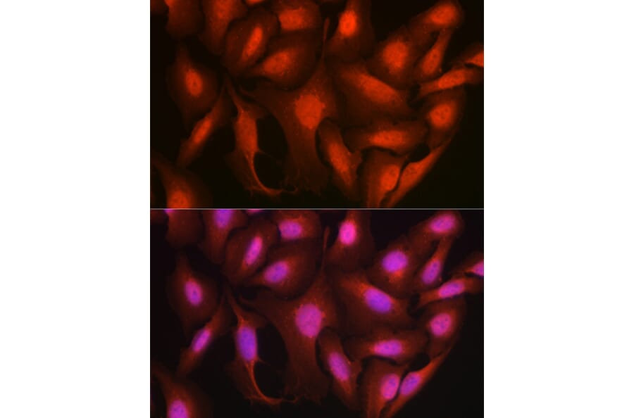 Immunofluorescence - Anti-Ataxin 3 Antibody (A13401) - Antibodies.com