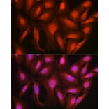 Immunofluorescence - Anti-Ataxin 3 Antibody (A13401) - Antibodies.com