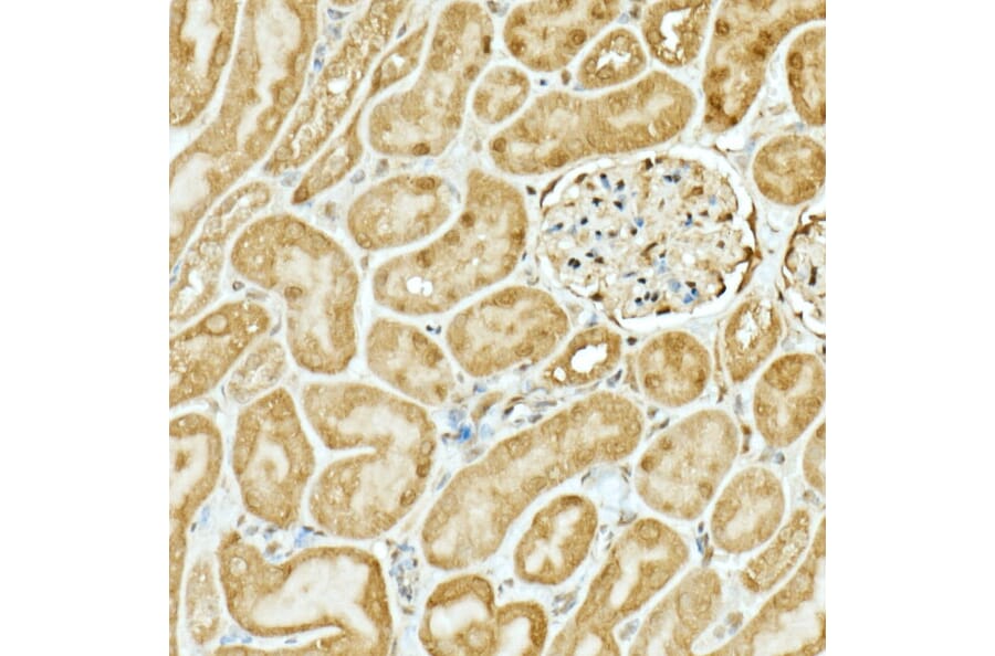 Immunohistochemistry - Anti-Nrf2 Antibody (A13402) - Antibodies.com