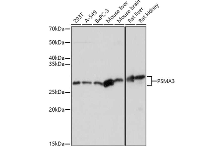 Western Blot - Anti-PSMA3 Antibody (A13403) - Antibodies.com