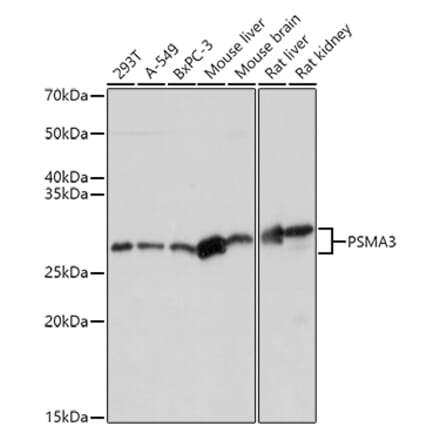 Western Blot - Anti-PSMA3 Antibody (A13403) - Antibodies.com