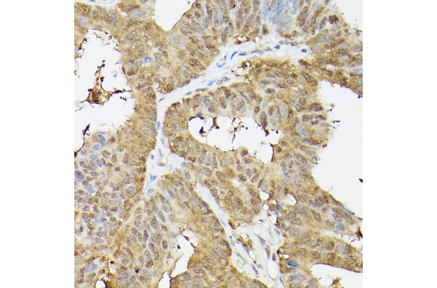 Immunohistochemistry - Anti-PSMA3 Antibody (A13403) - Antibodies.com