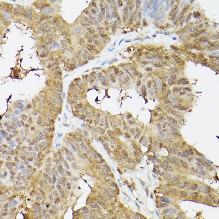 Immunohistochemistry - Anti-PSMA3 Antibody (A13403) - Antibodies.com