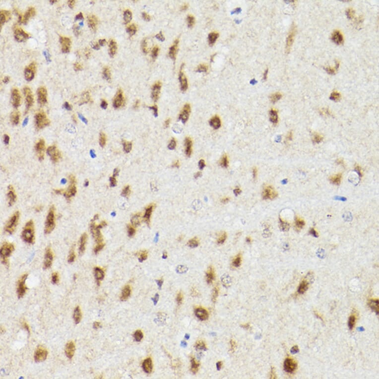 Immunohistochemistry - Anti-PSMA3 Antibody (A13403) - Antibodies.com